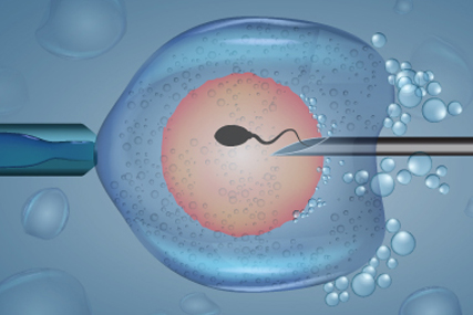 What Is In-Vitro-Fertilization (IVF)?